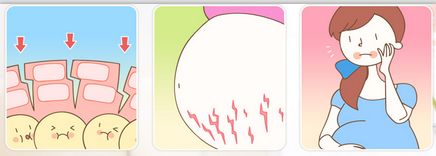 山東懸吊面部提升價格