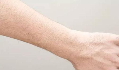 杭州眼袋內(nèi)切除價格表線上更新(杭州菁華醫(yī)療美容醫(yī)院眼袋內(nèi)切除參考價：4432元)