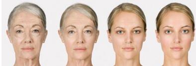 湘潭鼻梁矯正價(jià)位表可查看(湘潭前列人民醫(yī)院鼻梁矯正參考價(jià)：6322元)