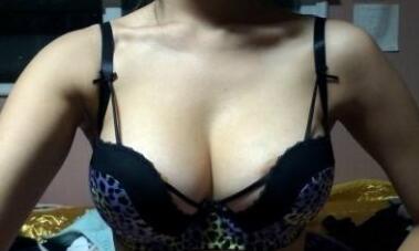 濰坊激光祛細紋價格表2023在線公開(山東濰坊中醫(yī)院醫(yī)學美容整形科激光祛細紋參考價：3349元)