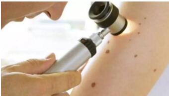 莆田激光面部年輕化價(jià)格