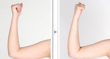 莆田非剝脫性點(diǎn)陣激光價(jià)格表2023版更新(莆田95醫(yī)院非剝脫性點(diǎn)陣激光參考價(jià)：6546元)