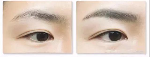 廣州腰腹光纖溶脂價(jià)格