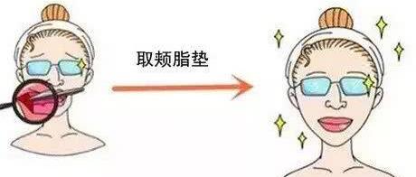 天津共振吸脂祛雙下巴手術(shù)費(fèi)用(費(fèi)用明細(xì))(天津第三中心醫(yī)院美容整形科共振吸脂祛雙下巴參考價(jià)：5938元)