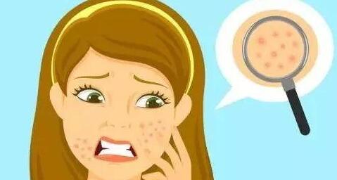 貴州射頻激光祛痘印2023費(fèi)用放出(貴州利美康外科醫(yī)院射頻激光祛痘印參考價(jià)：4466元)