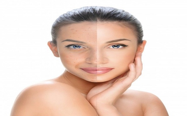 重慶眼底紋自體填充一次一般需要花多少錢(重慶瑪恩皮膚疤痕美容中心眼底紋自體填充參考價(jià)：3625元)