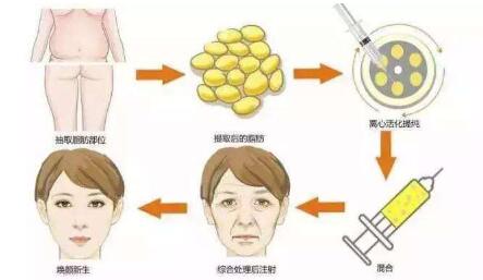 成都微調(diào)整形雙眼皮價格