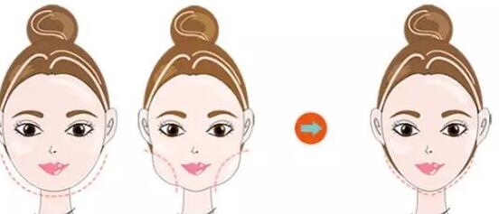 昆明細胞填充眼底紋的價錢需要多少錢一次(昆明海魅整形美容診所細胞填充眼底紋參考價：6081元)