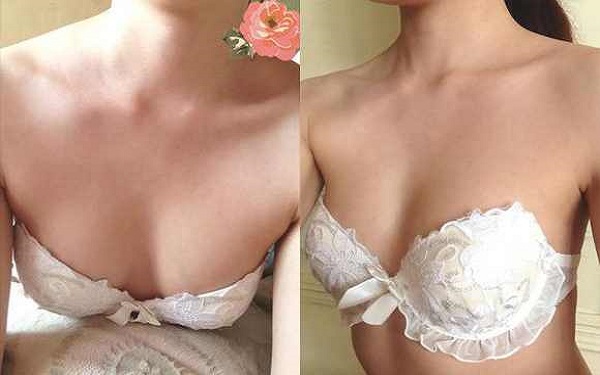 濟(jì)南手術(shù)去除頸紋費(fèi)用2023全面更新(濟(jì)南韓美整形美容醫(yī)院手術(shù)去除頸紋參考價：5594元)