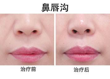 烏魯木齊耳朵畸形治療價(jià)格表公示(烏魯木齊馬龍醫(yī)療美容門(mén)診部耳朵畸形參考價(jià)：5788元)