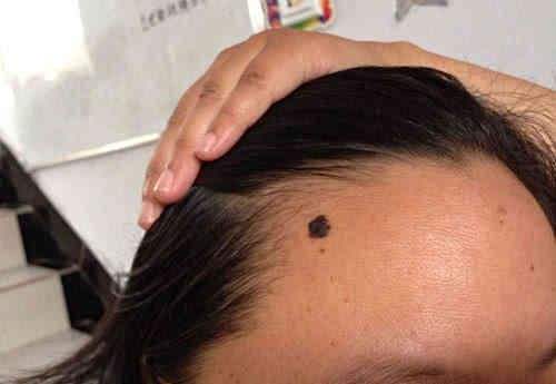 大慶臉型寬磨下頜角收費明細(xì)更新發(fā)布(大慶郭永波醫(yī)療美容診所臉型寬磨下頜角參考價：6837元)