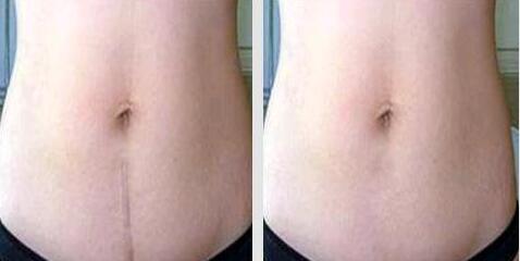 長(zhǎng)春水光針玻尿酸治療價(jià)格表出爐(長(zhǎng)春于荷琴醫(yī)療美容診所水光針玻尿酸參考價(jià)：3263元)