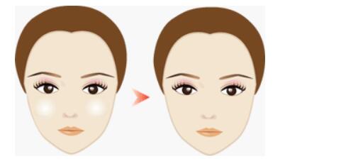 徐州自體脂肪顆粒注射移植豐唇術(shù)價(jià)格表近期公布搶先一看(徐州婦幼保健院整形科自體脂肪顆粒注射移植豐唇術(shù)參考價(jià)：4739元)