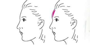 北京激光去眼紋治療價(jià)格表巨惠出爐(北京澳瑪國(guó)際醫(yī)療美容整形醫(yī)院激光去眼紋參考價(jià)：6629元)