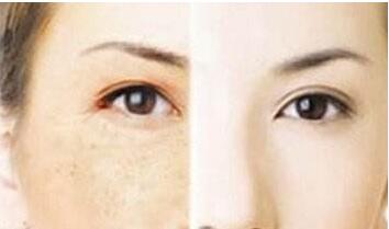 合肥隆乳美胸價格