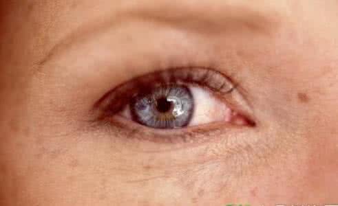 廈門微針祛除木偶紋優(yōu)惠價(jià)格公布(廈門曉明醫(yī)療美容診所微針祛除木偶紋參考價(jià)：4000元)