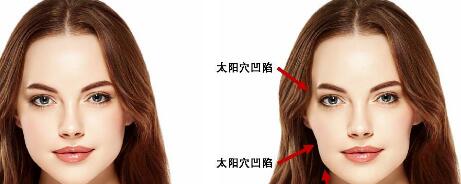 青島大腿吸脂術(shù)大腿吸脂整形價格信息查看(青島東劍整形大腿吸脂術(shù)大腿吸脂參考價：3923元)