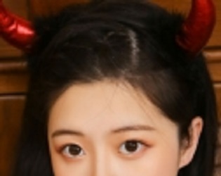 溫州打玻尿酸去淚溝費(fèi)用2023流出(溫州光明醫(yī)院皮膚科打玻尿酸去淚溝參考價(jià)：4034元)