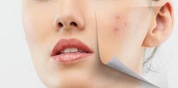 福州川字紋打玻尿酸價格多不多(福州臺江海峽醫(yī)療美容醫(yī)院川字紋打玻尿酸參考價：4841元)