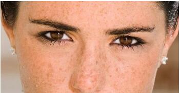 漳州玻尿酸去法令紋價(jià)格