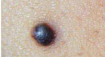 樂山耳廓畸形整復(fù)收費(fèi)標(biāo)準(zhǔn)詳情一覽(樂山嘉州西嬋醫(yī)學(xué)美容耳廓畸形整復(fù)參考價(jià)：4127元)