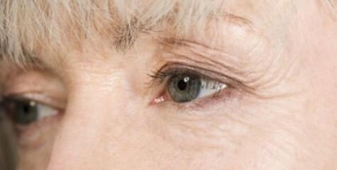 成都電波拉皮消除黑眼圈治療價位表公布(成都雅膚媛醫(yī)療美容診所電波拉皮消除黑眼圈參考價：5300元)