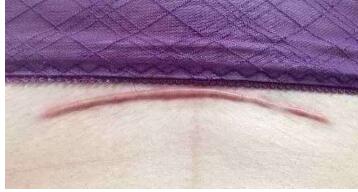 遵義伊維蘭豐額頭2023價(jià)目表，在線獲取(遵義伊美整形醫(yī)院伊維蘭豐額頭參考價(jià)：3022元)