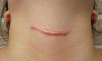 包頭面部五官塑型的費用大概需要多少價格(包頭尹麗霞醫(yī)學(xué)美容診所面部五官塑型參考價：6928元)