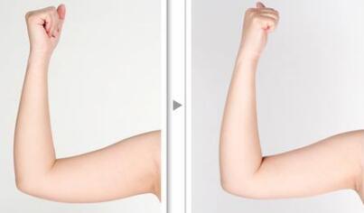 北京韓式隆下巴2023價格表明細(xì)查詢(北京歐邦美膚醫(yī)療美容診所韓式隆下巴參考價：5980元)