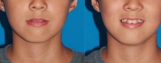 蚌埠三院整形美容中心：醫(yī)生資料、科室特色及價(jià)格匯總