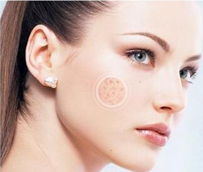 廣州麗港麗格醫(yī)療美容專家團(tuán)隊(duì)及雙眼皮案例分享