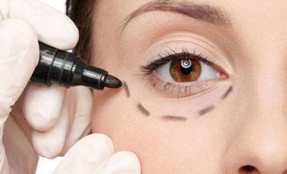 上海伊萊美醫(yī)療美容醫(yī)院口碑評價及錢玉鑫鼻子案例