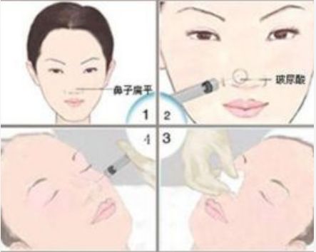 泉州想做吸脂？這些醫(yī)院信息分享給你！