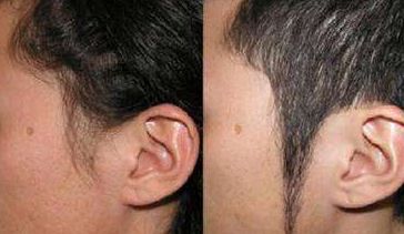 揭開(kāi)沈陽(yáng)假體隆胸醫(yī)院三甲高峰！童顏美譽(yù)響徹，技術(shù)引領(lǐng)行業(yè)