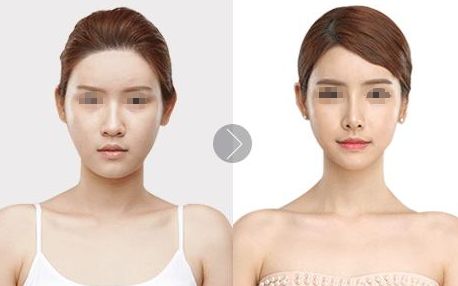 廈門哪里做雙眼皮好？5家醫(yī)院實(shí)力悉數(shù)揭曉