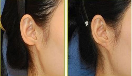 上海鼻整形醫(yī)生推薦：風格技術大盤點，找到適合你的ta！