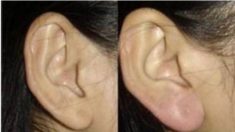 深圳龍華區(qū)整形醫(yī)院排名大揭秘！機(jī)構(gòu)前十實(shí)力對比！