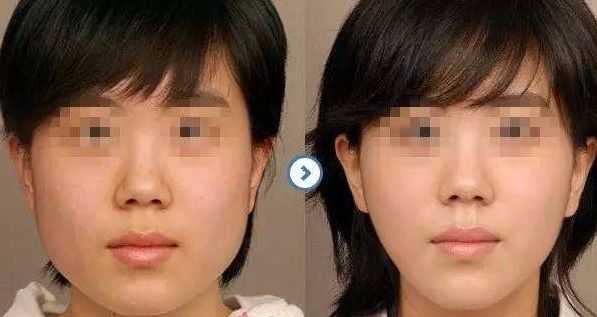 天津河西愛慕芳容醫(yī)學(xué)美容門診部：項目介紹及價格一覽