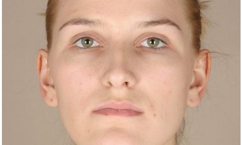 深圳 orthodontic 醫(yī)院推薦：哪家技術(shù)好又靠譜？