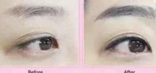 揭秘西安西美整形：資質(zhì)認證、口碑淺析