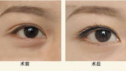 上海美萊整形醫(yī)院口碑怎么樣？熱門項(xiàng)目&專家團(tuán)隊(duì)詳解