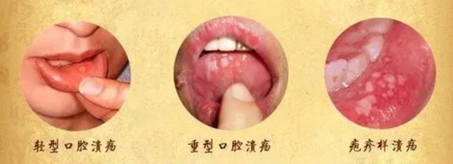 蕪湖眼部整形醫(yī)院排行榜【2024最新】