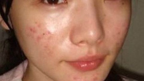 九江隆胸醫(yī)生怎么選？技術(shù)口碑都很重要！