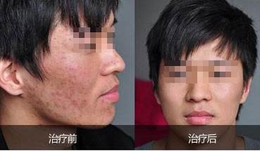 鄭州哪些醫(yī)生能夠進(jìn)行外耳整形手術(shù)？口碑TOP7名單揭曉！