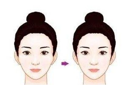 泉州鼻整形醫(yī)院推薦：口碑與實力兼具的選擇！