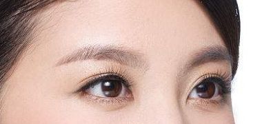 北京麗星翼美醫(yī)療美容評價：整形特色解析及雙眼皮手術(shù)口碑