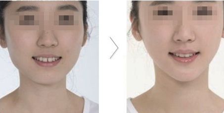 南京嘉怡美吸脂效果好嗎？專家團(tuán)隊與真實評價分析