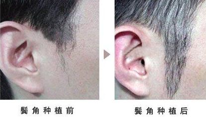 北京加減美整形醫(yī)院：祛皺抗衰大揭秘！