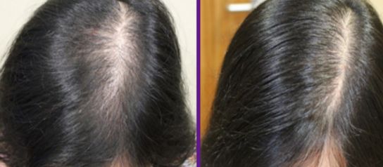 合肥鼻部整形醫(yī)院排行榜公布：權(quán)威評(píng)選出的5家！