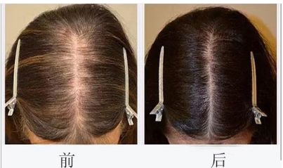長沙湘雅二院眼整形醫(yī)生推薦：王玉銀、李曉芳等口碑技術(shù)分析！